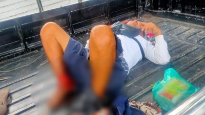 Ditabrak di Jalan Raya, Kaki Seorang Warga Nyaris Putus