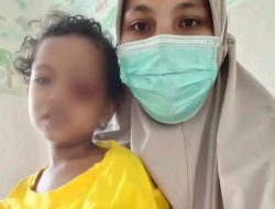 Balita Penderita Tumor Mata Belum Dapat Bantuan dari Pemkab Halmahera Barat